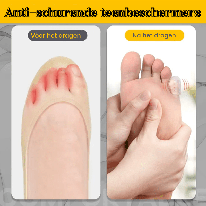 Silicone anti-friction toe protector