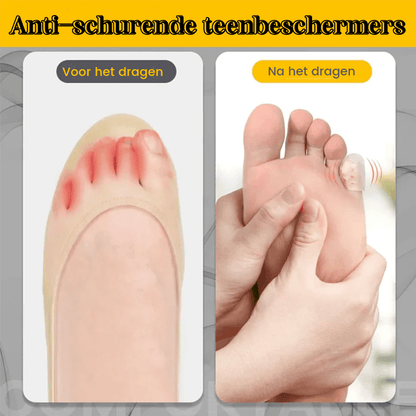 Silicone anti-friction toe protector