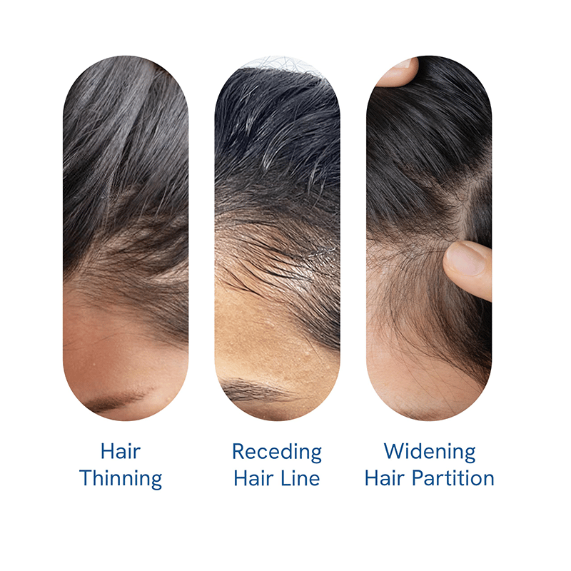 Advanced Hair Growth Roll-On Serum