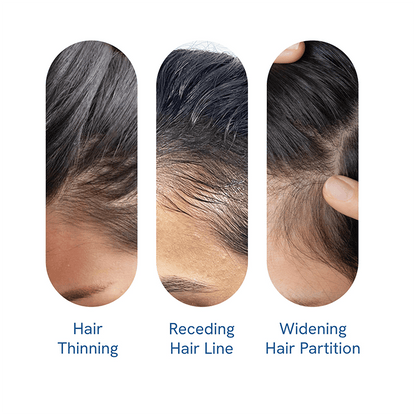 Advanced Hair Growth Roll-On Serum